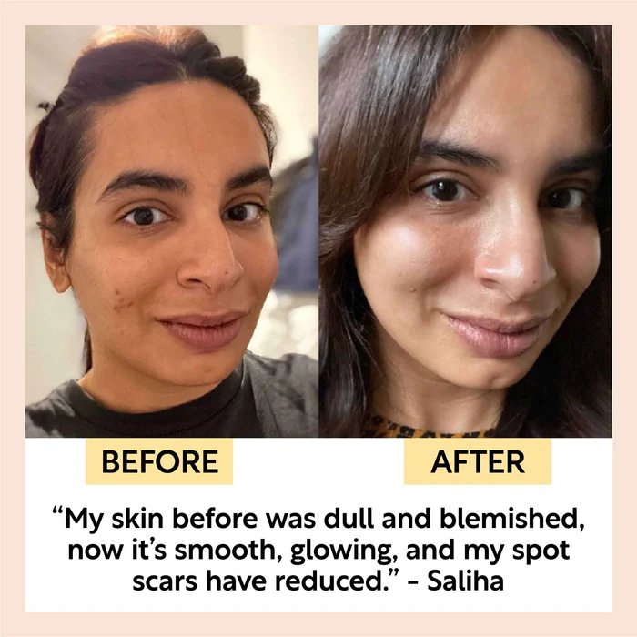 Before and after results with UVYNA brush - smoother, glowing skin