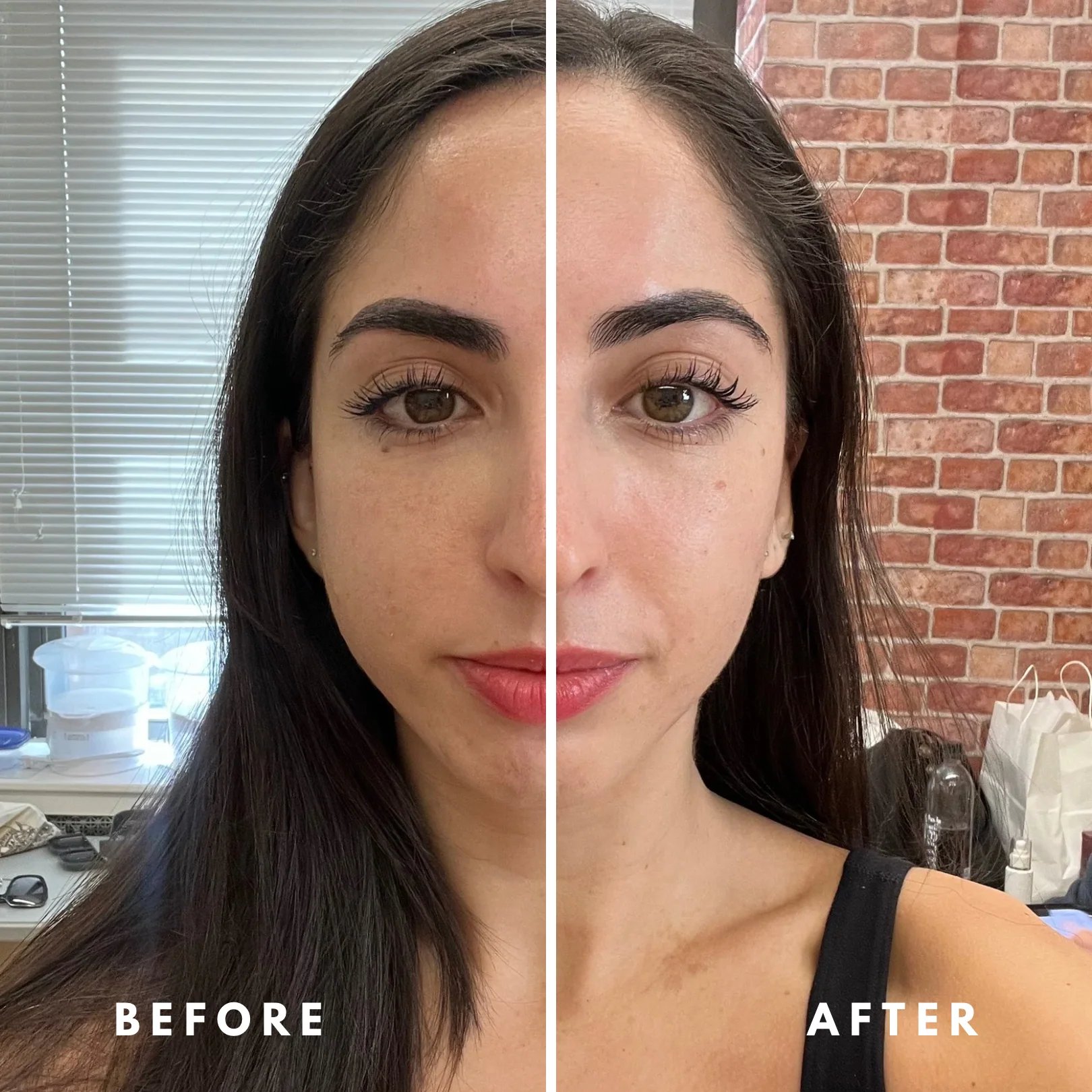 Before and after using UVYNA Lymphatic Face Brush